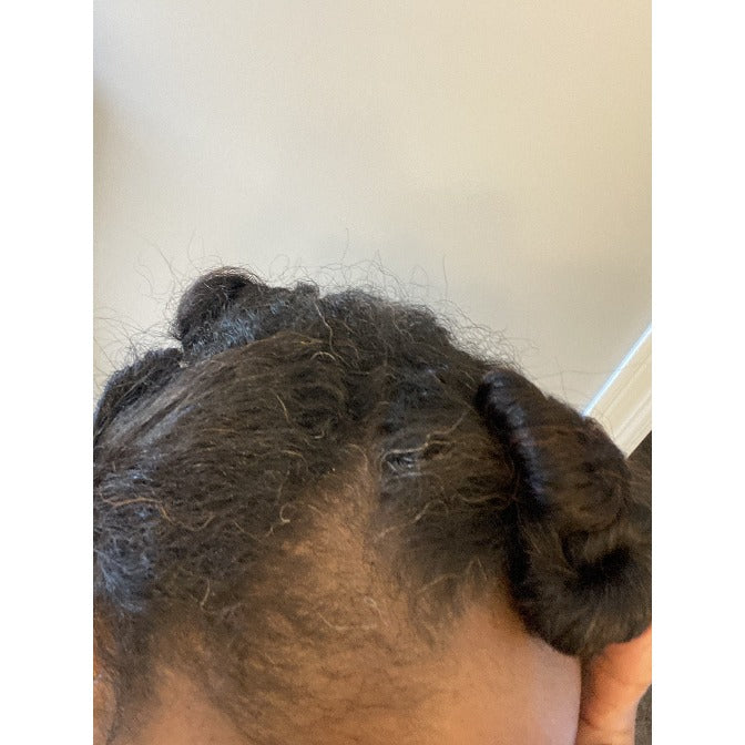 Simple Hair oil with Black Cumin Seed Customer Before and After Pictures.